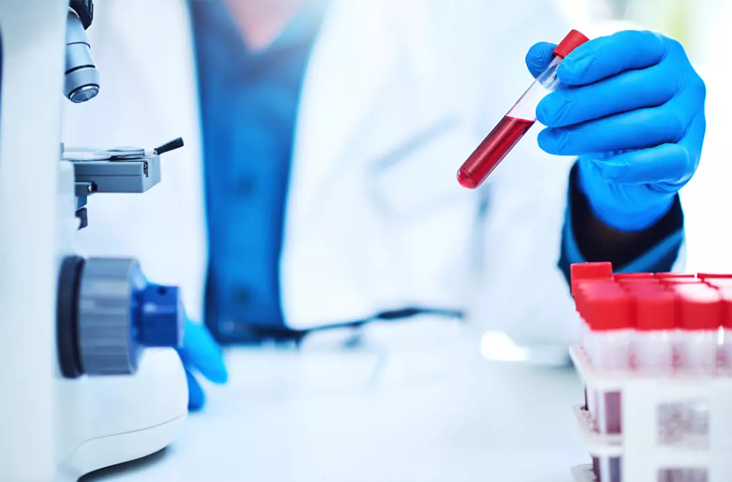 <strong>3 millions</strong> de dollars pour la recherche sur les cancers du sang