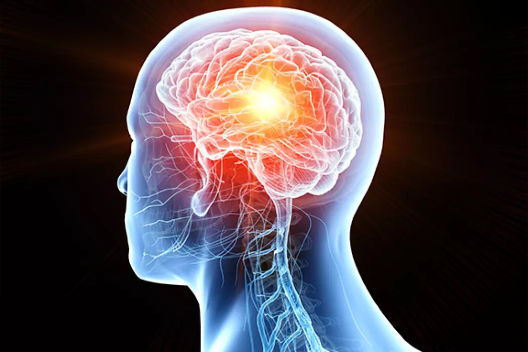 <strong>2 000 000 $ pour le cancer</strong> du cerveau en partenariat avec Brain Canada